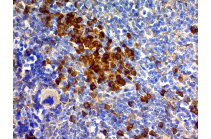 Immunohistochemistry - Anti-CD63 Antibody [MX-49.129.5] (A250748) - Antibodies.com