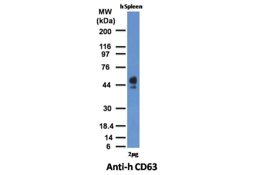 Western Blot - Anti-CD63 Antibody [MX-49.129.5] (A250748) - Antibodies.com