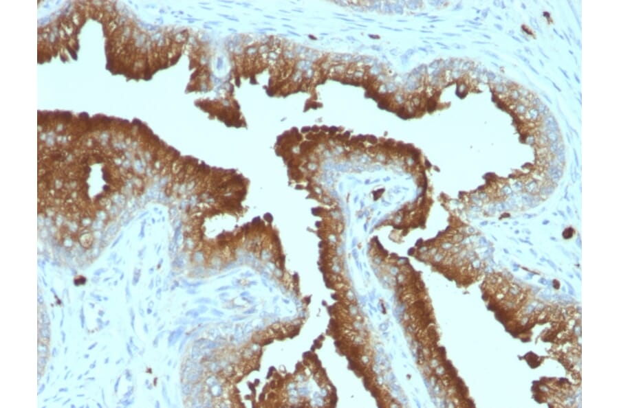 Immunohistochemistry - Anti-CD63 Antibody [MX-49.129.5] (A250748) - Antibodies.com