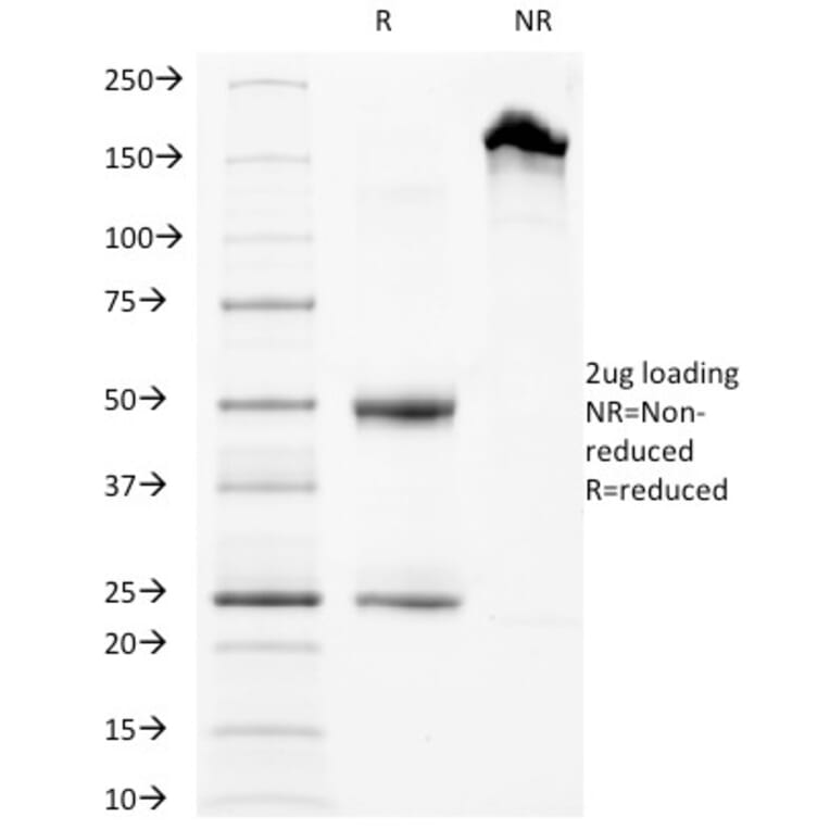 SDS-PAGE - Anti-CD63 Antibody [LAMP3/968] (A250750) - Antibodies.com