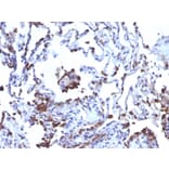 Immunohistochemistry - Anti-CD63 Antibody [NKI/C3 + LAMP3/968] (A250750) - Antibodies.com