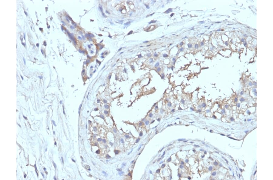Immunohistochemistry - Anti-CD63 Antibody [NKI/C3 + LAMP3/968] (A250751) - Antibodies.com
