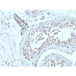 Immunohistochemistry - Anti-CD63 Antibody [NKI/C3 + LAMP3/968] (A250751) - Antibodies.com