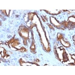 Immunohistochemistry - Anti-CD63 Antibody [NKI/C3 + LAMP3/968] (A250751) - Antibodies.com