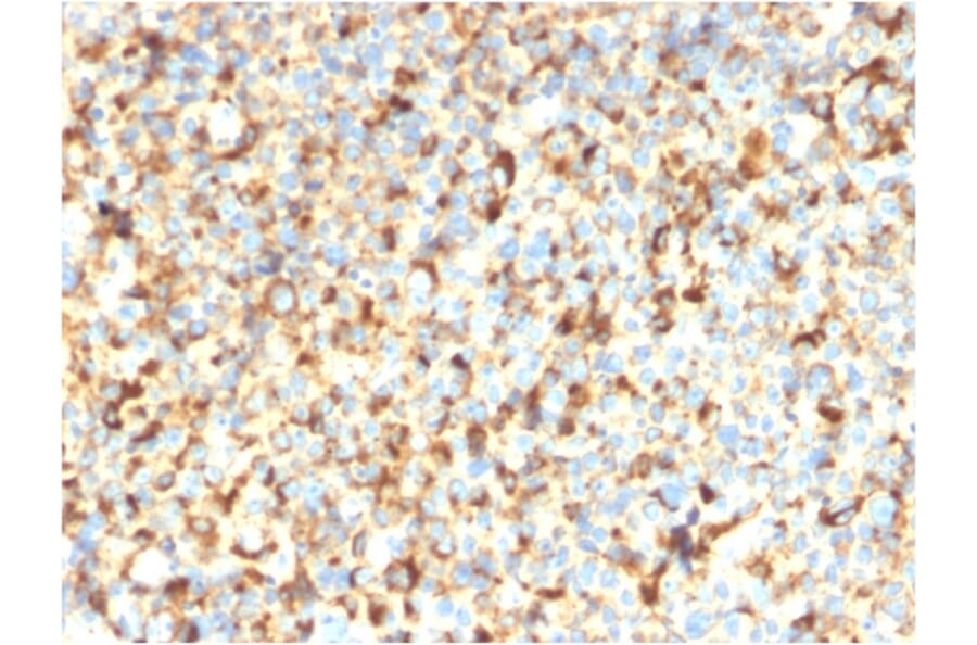 Immunohistochemistry - Anti-CD63 Antibody [rMX-49.129.5] (A250752) - Antibodies.com