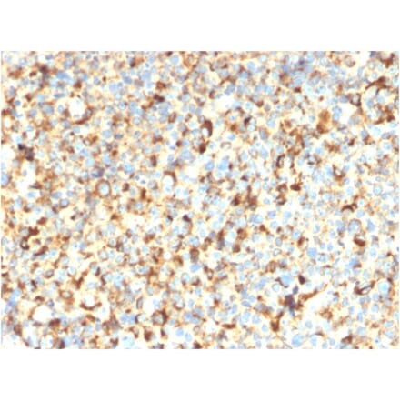 Immunohistochemistry - Anti-CD63 Antibody [rMX-49.129.5] (A250752) - Antibodies.com