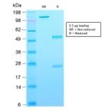 SDS-PAGE - Anti-CD63 Antibody [rMX-49.129.5] (A250752) - Antibodies.com