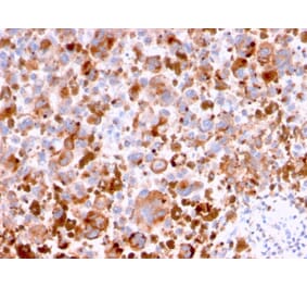 Immunohistochemistry - Anti-CD63 Antibody [LAMP3/2788] (A250753) - Antibodies.com