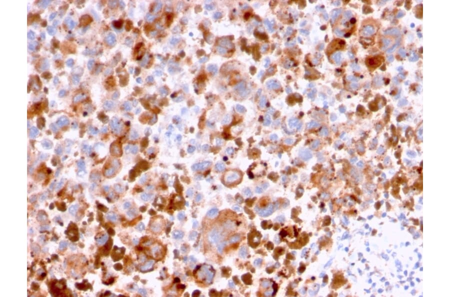 Immunohistochemistry - Anti-CD63 Antibody [LAMP3/2788] (A250753) - Antibodies.com