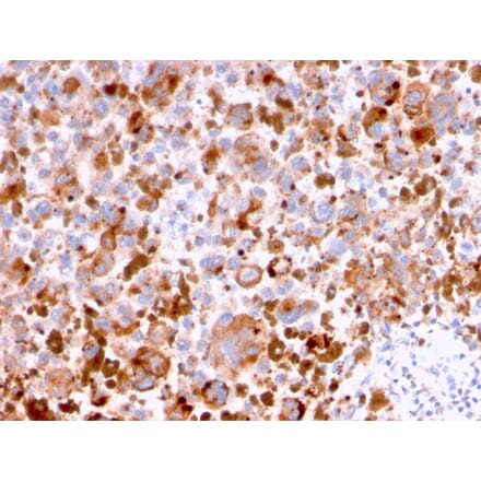 Immunohistochemistry - Anti-CD63 Antibody [LAMP3/2788] (A250753) - Antibodies.com