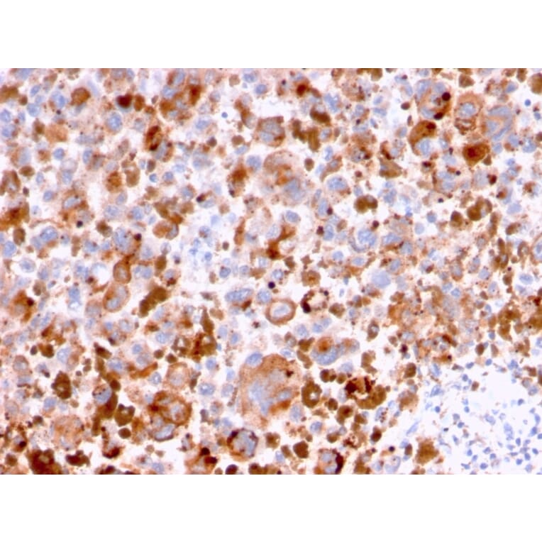 Immunohistochemistry - Anti-CD63 Antibody [LAMP3/2788] (A250753) - Antibodies.com