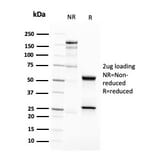 SDS-PAGE - Anti-CD63 Antibody [LAMP3/2788] (A250753) - Antibodies.com