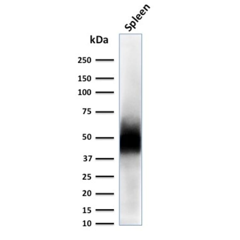 Western Blot - Anti-CD63 Antibody [LAMP3/2788] (A250753) - Antibodies.com