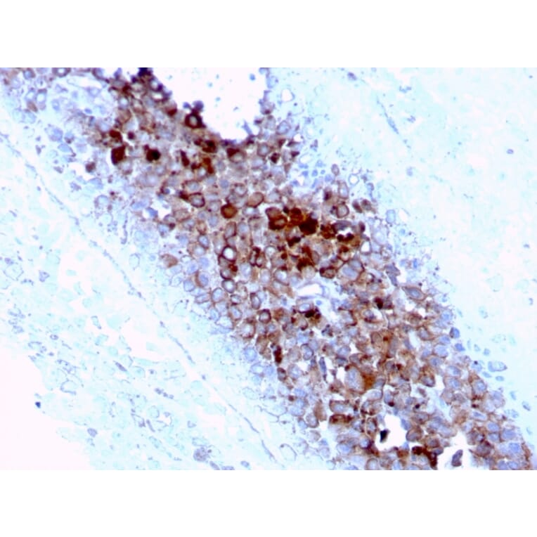Immunohistochemistry - Anti-CD63 Antibody [LAMP3/2789] (A250754) - Antibodies.com