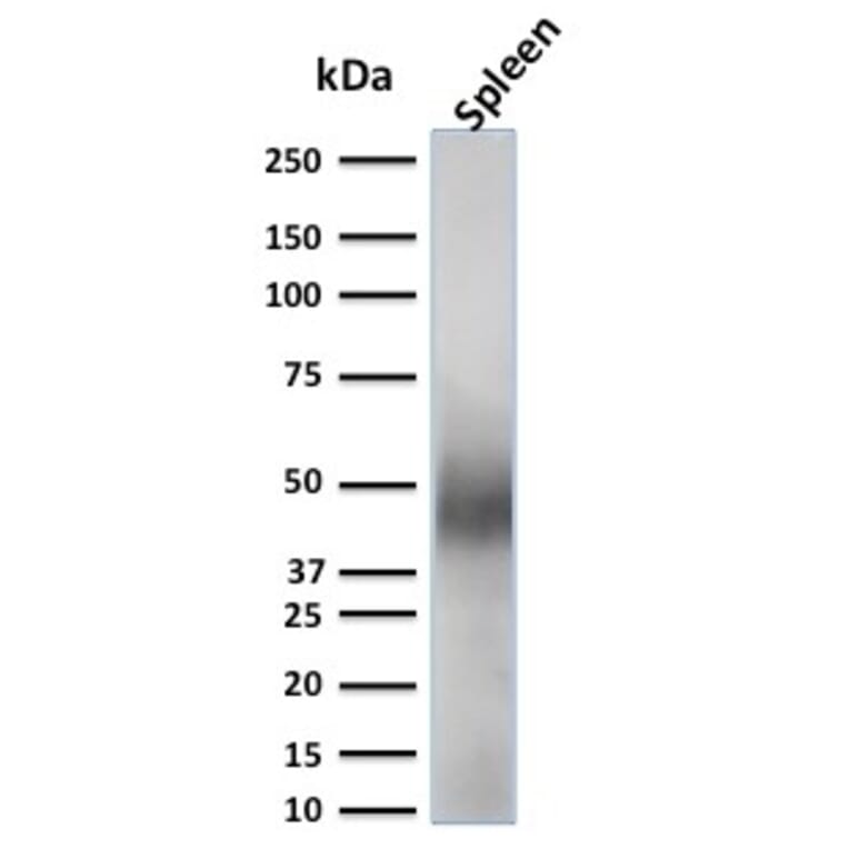 Western Blot - Anti-CD63 Antibody [LAMP3/2789] (A250754) - Antibodies.com
