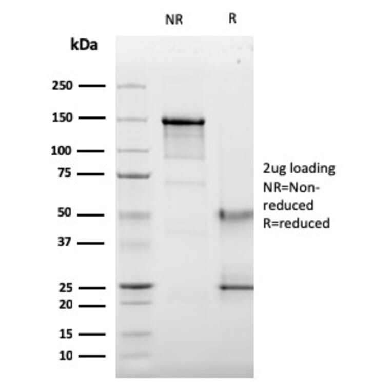 SDS-PAGE - Anti-CD63 Antibody [LAMP3/2789] (A250754) - Antibodies.com