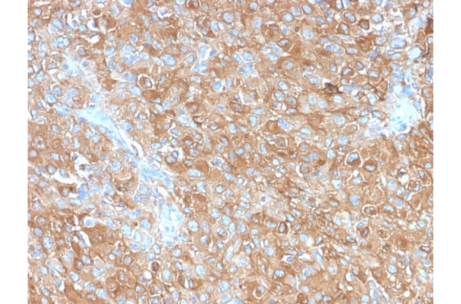 Immunohistochemistry - Anti-CD63 Antibody [LAMP3/2990R] (A250755) - Antibodies.com