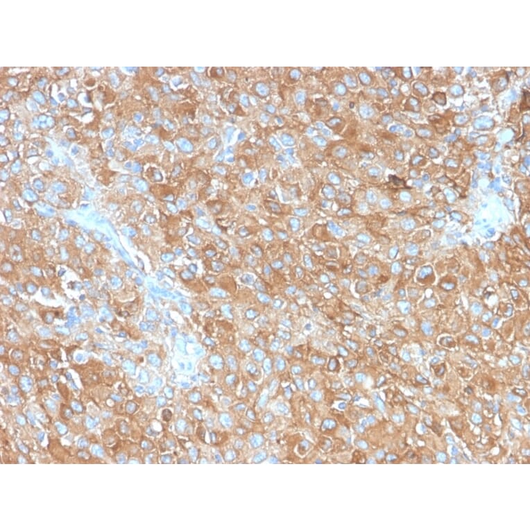 Immunohistochemistry - Anti-CD63 Antibody [LAMP3/2990R] (A250755) - Antibodies.com