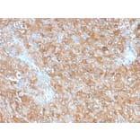 Immunohistochemistry - Anti-CD63 Antibody [LAMP3/2990R] (A250755) - Antibodies.com