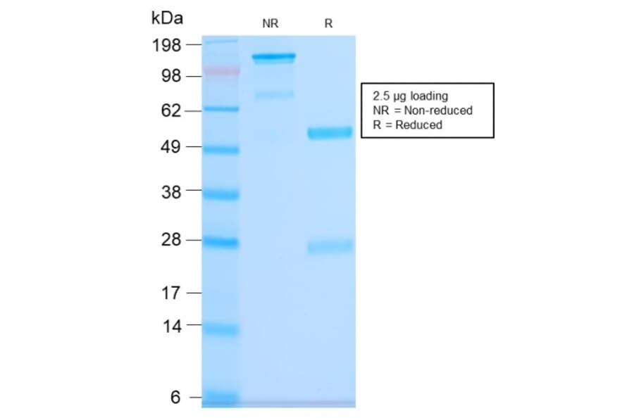 SDS-PAGE - Anti-CD63 Antibody [LAMP3/2990R] (A250755) - Antibodies.com