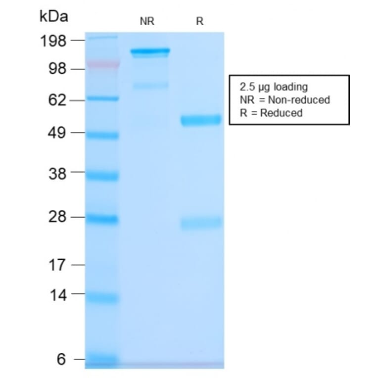 SDS-PAGE - Anti-CD63 Antibody [LAMP3/2990R] (A250755) - Antibodies.com