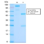 SDS-PAGE - Anti-CD63 Antibody [LAMP3/2990R] (A250755) - Antibodies.com