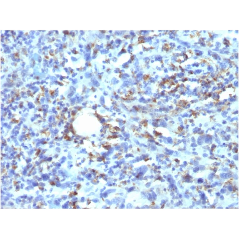 Immunohistochemistry - Anti-CD68 Antibody [rLAMP4/824] (A250756) - Antibodies.com
