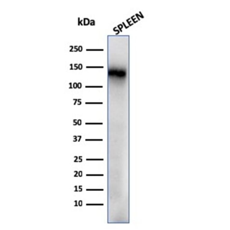Western Blot - Anti-CD68 Antibody [rLAMP4/824] (A250756) - Antibodies.com