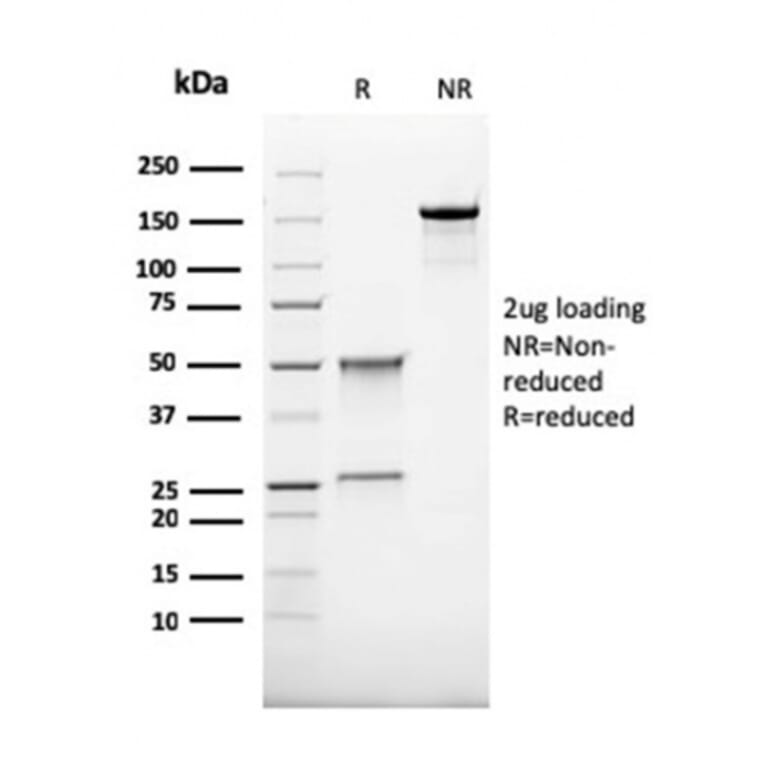 SDS-PAGE - Anti-CD68 Antibody [rLAMP4/824] (A250756) - Antibodies.com