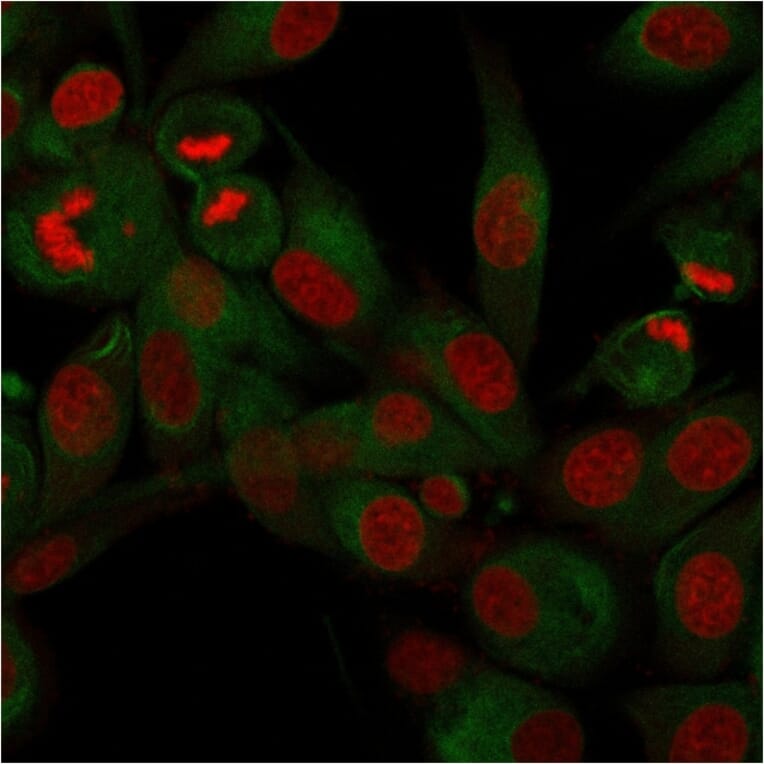 Immunofluorescence - Anti-CD68 Antibody [rLAMP4/824] (A250755) - Antibodies.com