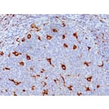 Immunohistochemistry - Anti-CD68 Antibody [KP1] (A250756) - Antibodies.com
