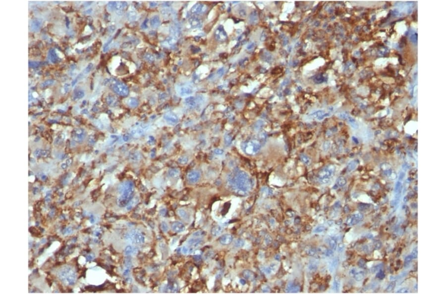 Immunohistochemistry - Anti-CD68 Antibody [C68/684] (A250759) - Antibodies.com