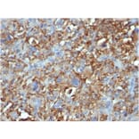 Immunohistochemistry - Anti-CD68 Antibody [C68/684] (A250759) - Antibodies.com