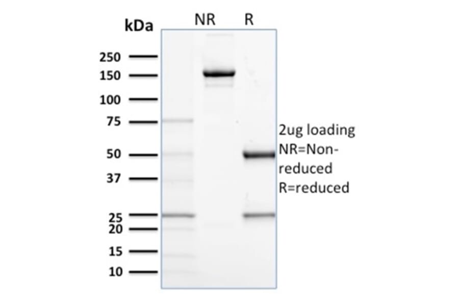 SDS-PAGE - Anti-CD68 Antibody [C68/684] (A250759) - Antibodies.com