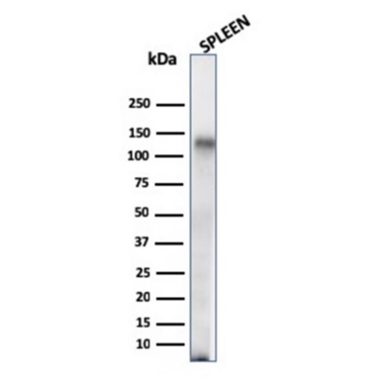 Western Blot - Anti-CD68 Antibody [C68/684] (A250759) - Antibodies.com