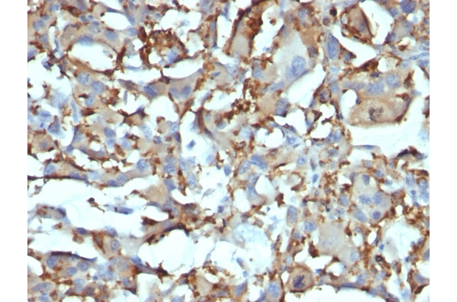 Immunohistochemistry - Anti-CD68 Antibody [KP1 + C68/684] (A250759) - Antibodies.com