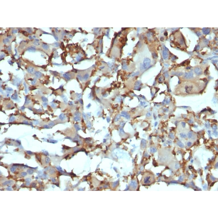 Immunohistochemistry - Anti-CD68 Antibody [KP1 + C68/684] (A250759) - Antibodies.com