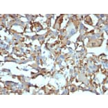 Immunohistochemistry - Anti-CD68 Antibody [KP1 + C68/684] (A250759) - Antibodies.com