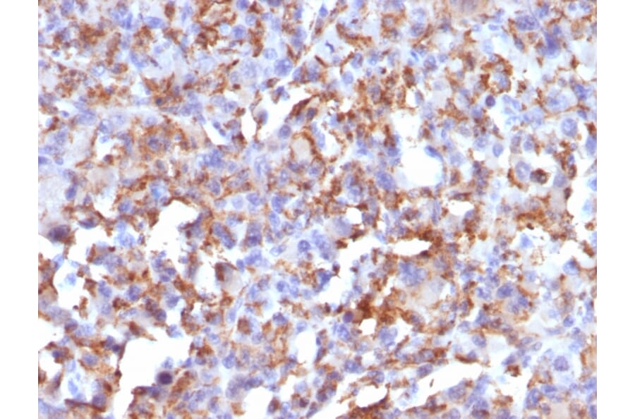 Immunohistochemistry - Anti-CD68 Antibody [LAMP4/824] (A250761) - Antibodies.com