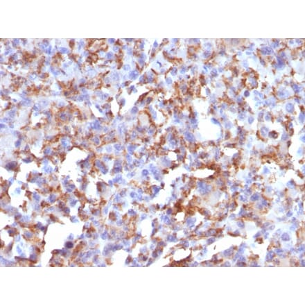 Immunohistochemistry - Anti-CD68 Antibody [LAMP4/824] (A250761) - Antibodies.com