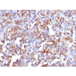 Immunohistochemistry - Anti-CD68 Antibody [LAMP4/824] (A250761) - Antibodies.com