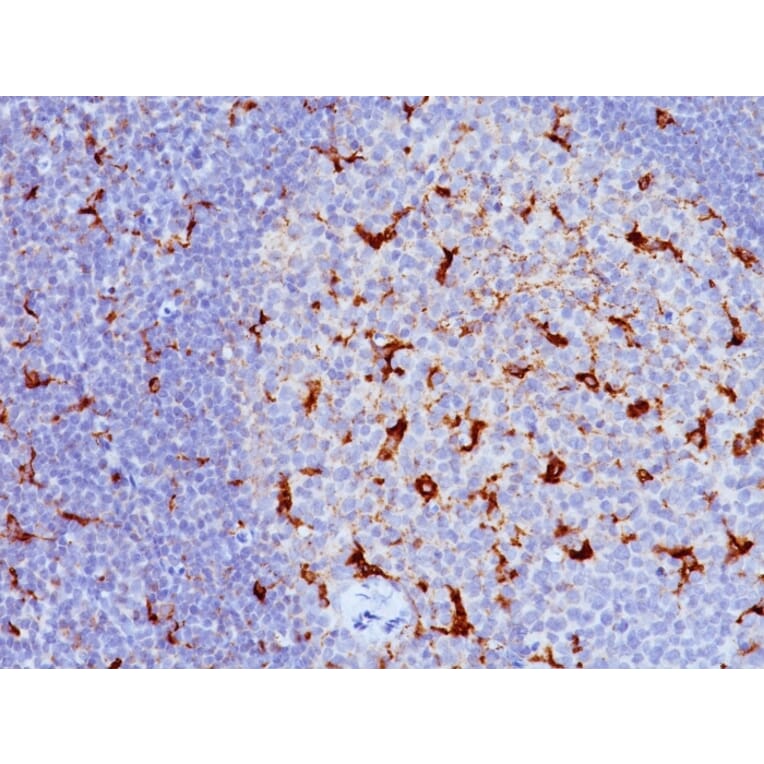 Immunohistochemistry - Anti-CD68 Antibody [LAMP4/824] (A250761) - Antibodies.com