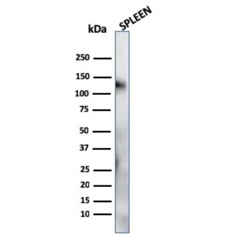 Western Blot - Anti-CD68 Antibody [LAMP4/824] (A250761) - Antibodies.com