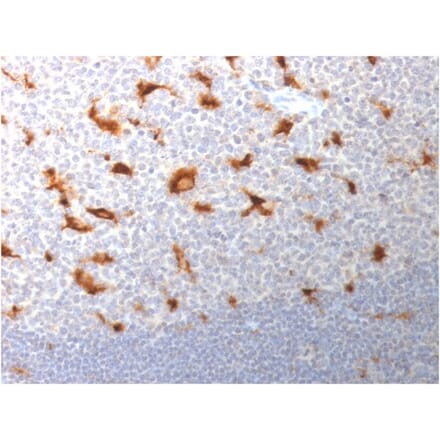 Immunohistochemistry - Anti-CD68 Antibody [LAMP4/1830] (A250763) - Antibodies.com