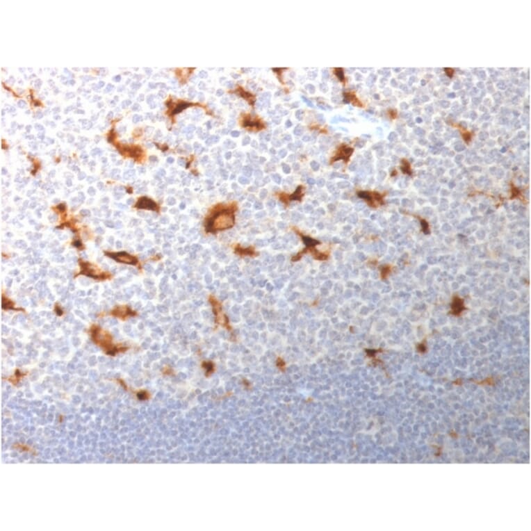 Immunohistochemistry - Anti-CD68 Antibody [LAMP4/1830] (A250763) - Antibodies.com
