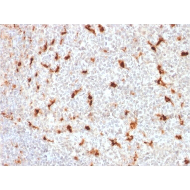 Immunohistochemistry - Anti-CD68 Antibody [LAMP4/1830] (A250763) - Antibodies.com