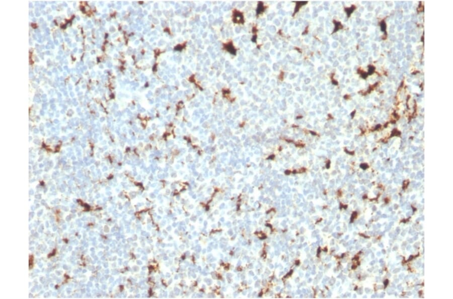Immunohistochemistry - Anti-CD68 Antibody [C68/2511] (A250765) - Antibodies.com