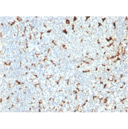 Immunohistochemistry - Anti-CD68 Antibody [C68/2511] (A250765) - Antibodies.com
