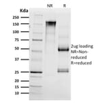 SDS-PAGE - Anti-CD68 Antibody [C68/2511] (A250765) - Antibodies.com