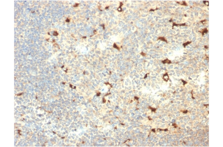 Immunohistochemistry - Anti-CD68 Antibody [C68/2709] (A250766) - Antibodies.com